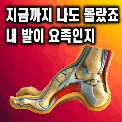 YY 나꼰대 요족깔창