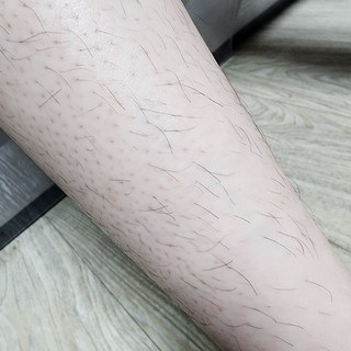 갤러리 이미지