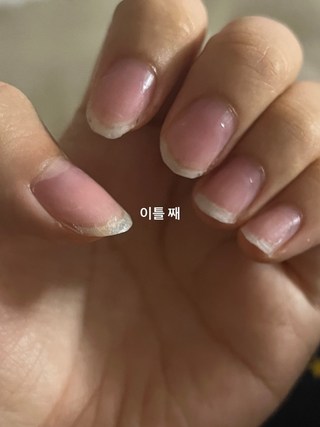 갤러리 이미지
