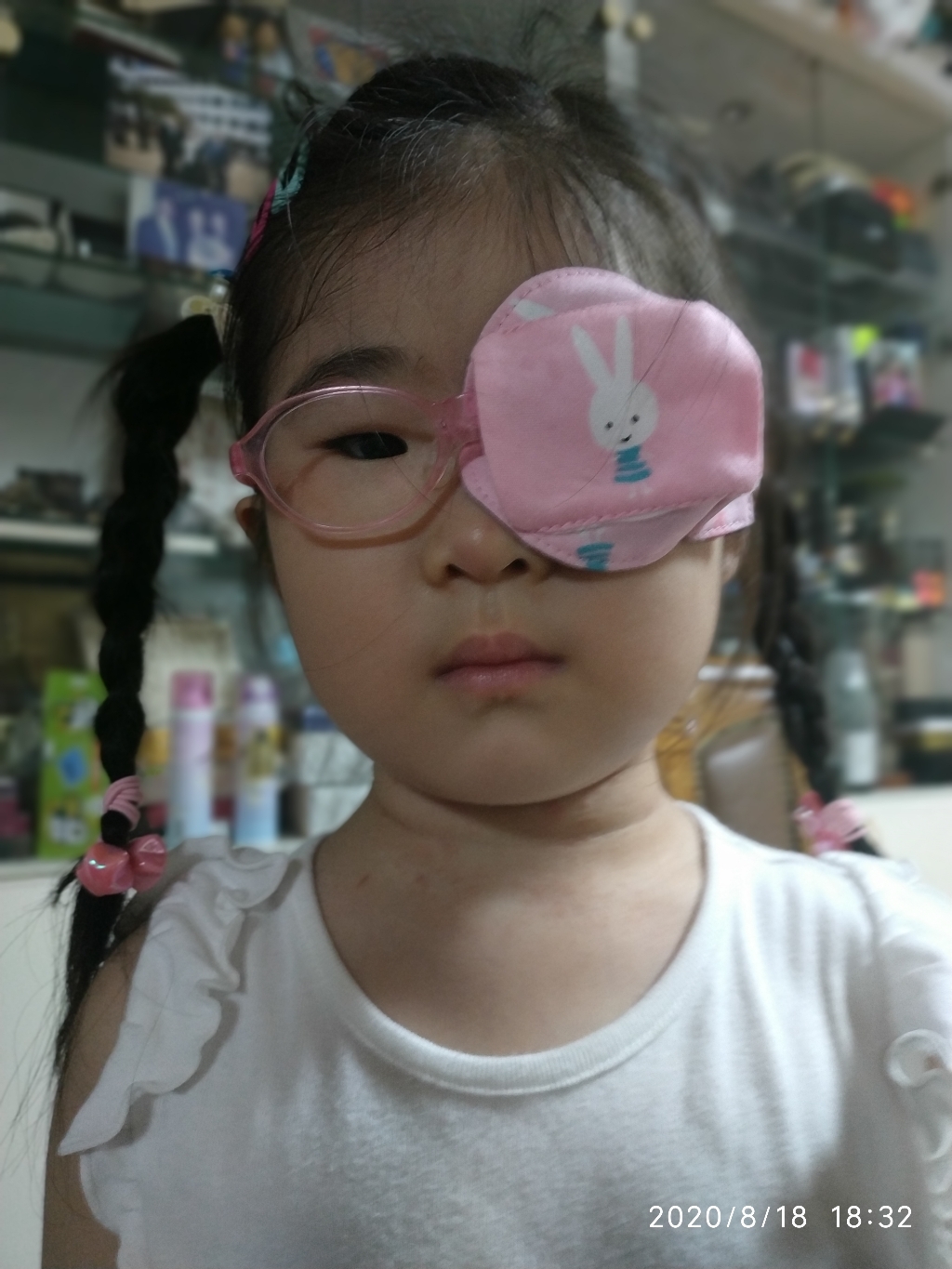 뉴월코 핑크토끼 좌안 비접착식 가림패치 가림막 약시 훈련 사시 치료 외눈 안대