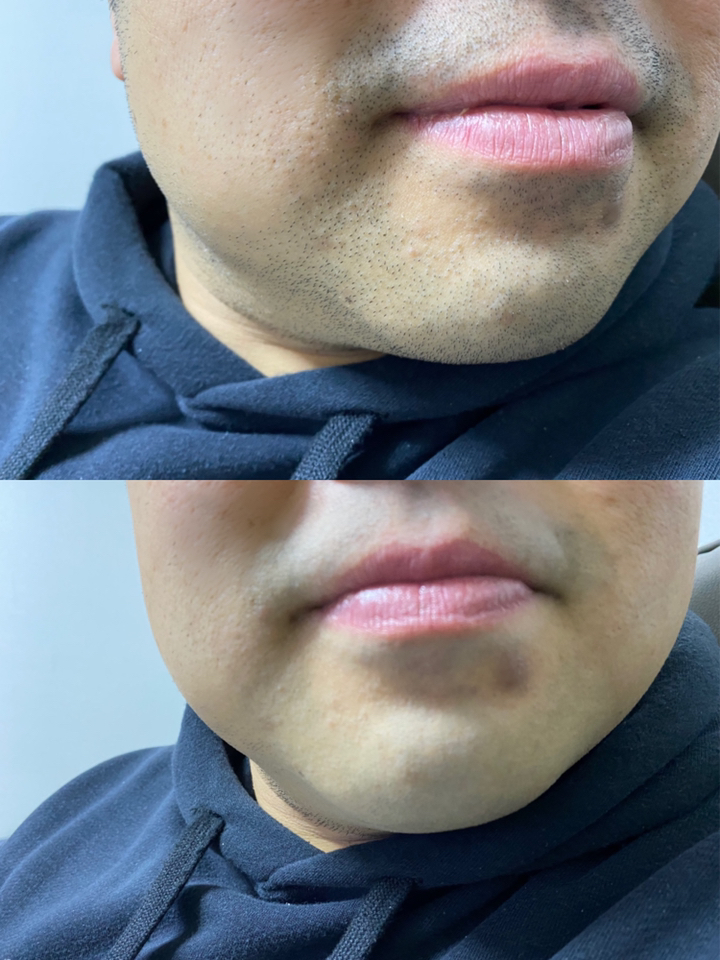 BRAUN 시리즈 9 전기면도기 리뷰후기