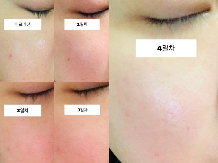 닥터지 레드 블레미쉬 시카 S 크림 리뷰후기