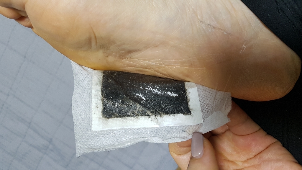 헬스프렌드 풋톡스 목초수액 힐링 발바닥 패치 36매18일분 대용량