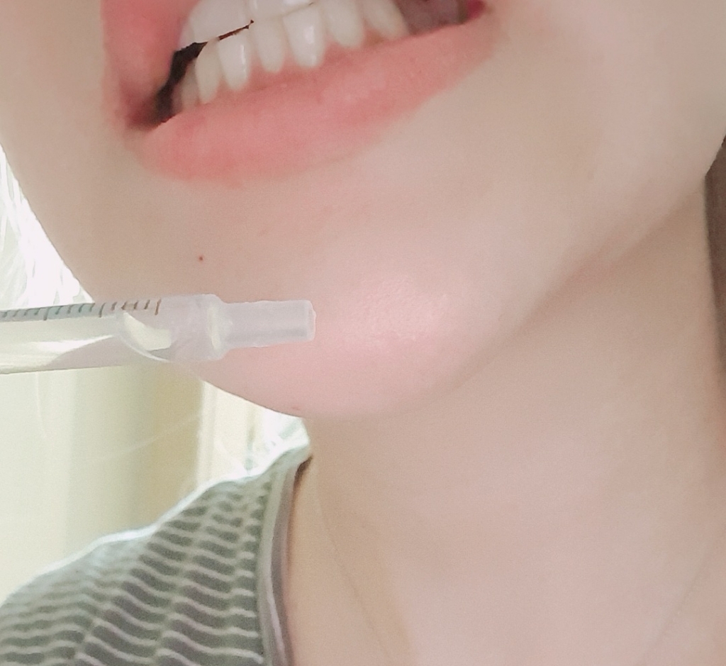 투스노트 화이트닝 겔개구기케이스 리뷰 후기