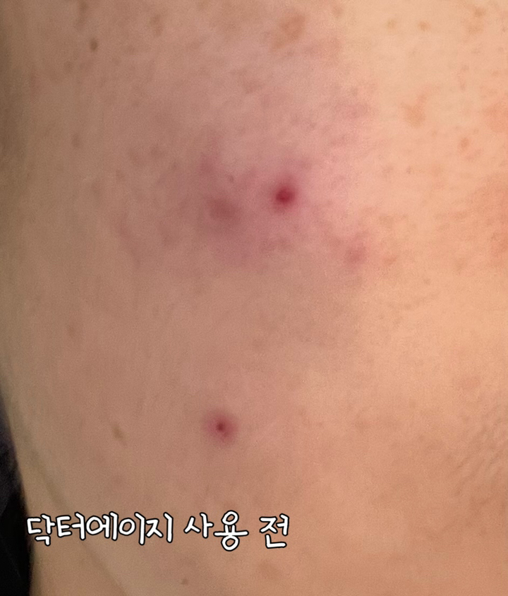 닥터에이지 시카 진정패드 60매 2개 시카 진정앰플 2개 1세트