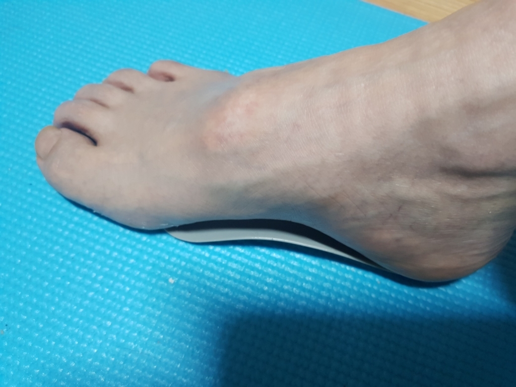 교정구 평발 아치 기능성 교정 족저근막 깔창