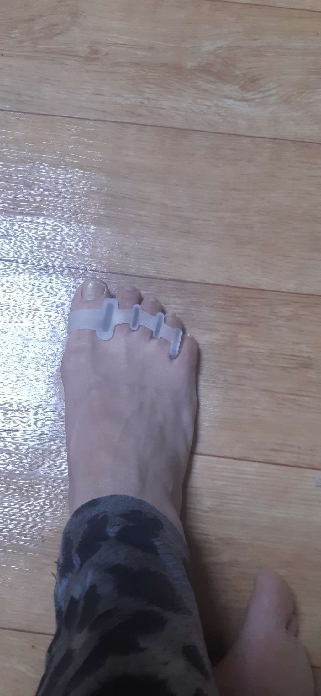 바른 자세 실리콘 발가락 교정기