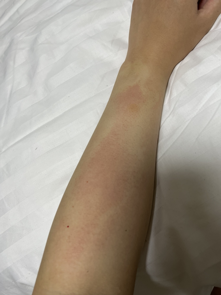 있어빌리티 셀프왁싱 브라질리언 재사용 가능한 바디 뷰티 도구 물리적 제모기 핑크
