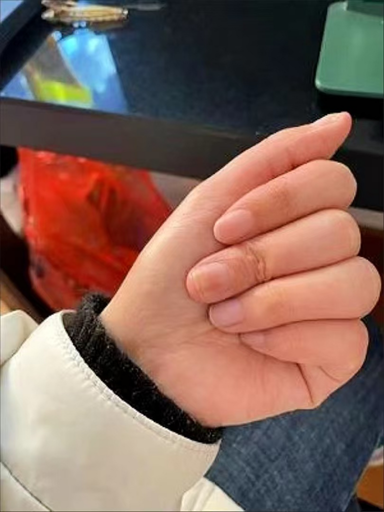 손톱재생 케어 손톱영양제 강화제 문제성 손톱 보조제 큐티클오일 윤기있는 건강한 손톱만들기 손톱 영양제 오일펜 짧은 손톱 고민 해결, 1개, 10ml