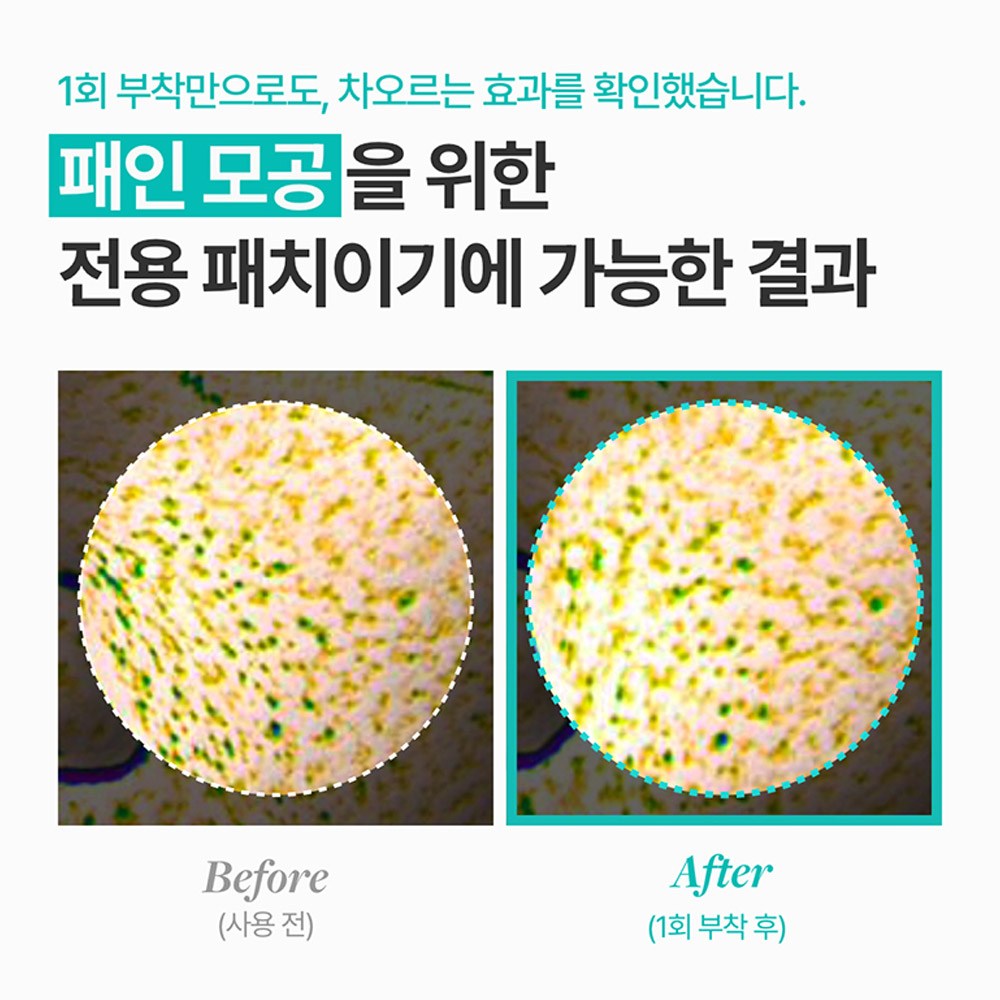 확장된 모공을 줄여 환한 피부로!