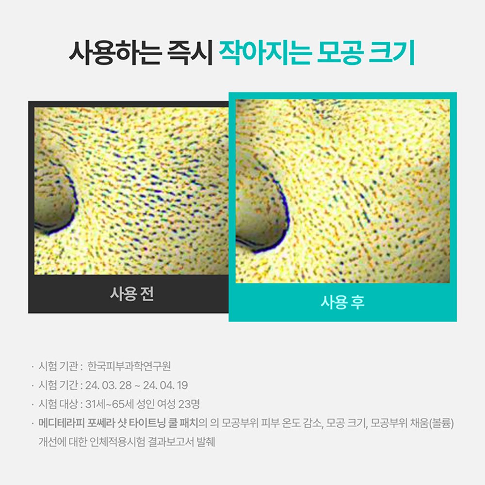 확장된 모공을 줄여 환한 피부로!