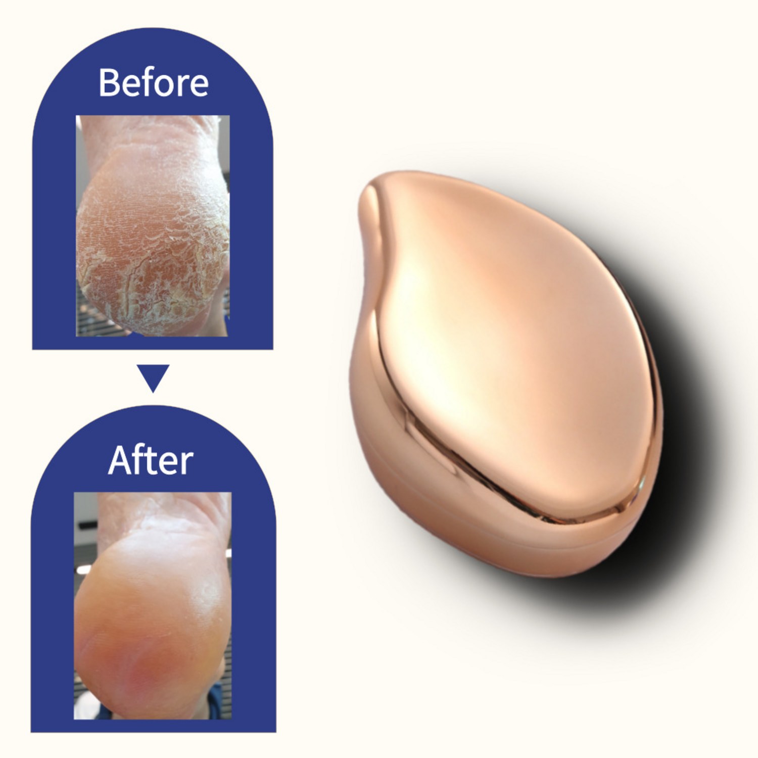 발각질제거기로 매끄러운 발 표현하기