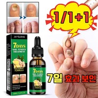 [국내배송] 발톱 약 치료제 손톱 영양제 강화제 진균 리페어 에선스 케어 앰플 포장증정, 1개, 30ml