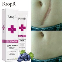 흉터 제거 크림 딥 리페어 스킨은 피부 밝기를 향상시킵니다. 딥 리페어 효과적인 흉터 제거 케어 연고