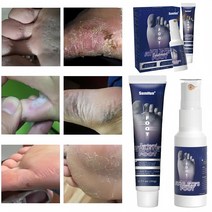 발톱 무좀약 연고 목초액 무좀치료 스프레이 발냄새 제거 가려움증 연고, (20g+60mL), 2개