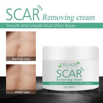 흉터 제거 크림 Scald 화상 오래된 여드름 마크 수술 후 치료 스킨 케어 스무딩 복구 30g TSLM1