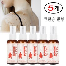 5개 백반증 분무 흰 반점 케어 세균 억제액 Vitiligo Treament