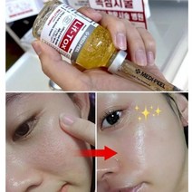 주사기 실리프팅 필러앰플/잔주름 눈가주름 팔자주름 이마주름 스킨케어세트, 5%리프팅앰플 과 탱탱볼크림