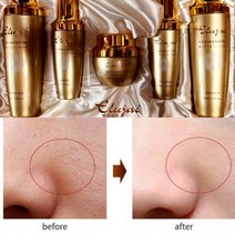 엘루자이 기미지우개 5종세트 흑점 제거/시트마스크 고흡수 아데노신 기능성 한방케어/기능성 스킨케어, 주름 기미지우개기초5종+주름지우개마스크20매