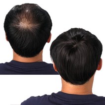 감쪽이 가발 국내생산 남여공용 정수리가발 고열사 부분가발, 1개, 2.감쪽이(자연갈색)