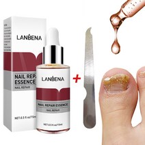 무좀 내성발톱 발톱무좀 LANBENA-네일 리페어 에센스 세럼 네일 트리트먼트 풋 곰팡이 제거 젤 손발톱, 한개옵션0