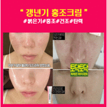 갱년기 홍조 크림 식물성 에스트로겐 크림 안면홍조 피부탄력 기미제거, 체험형 홍조 크림 1개