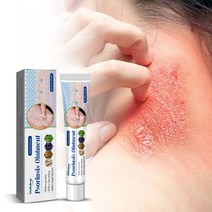 MAYEE 건선 연고 건선 두드러기 지루성피부염 접촉피부염 두피 건선 피부, 20ml, 4개