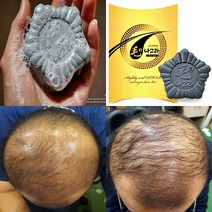 모나그라 비누 원형 M자 탈모 두피 발모 정수리 어린이 초기 임산부 샴푸바, 모나그라 비누 1개