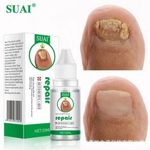 발바닥 각화형 무좀 발톱무좀 치료 약 연고 발냄새없애는법, 1개
