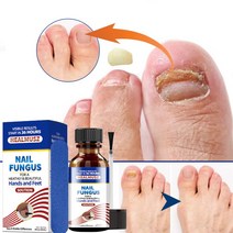 HEALMUSZ 발톱무좀치료 발톱무좀약 발톱무좀연고 발무좀연고 리페어 에센스, 1개, 30ml