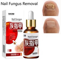 조갑사상균증개선 발냄새제거 발톱무좀연고 손톱 곰팡이 치료 발 관리 에센스 네일 오일 제거 젤 손발톱진균증 감염 방지, 1개