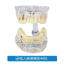 치아 모형 교육 치위생 관리 모양 덴티폼 치과놀이 구강 재료상, M4001