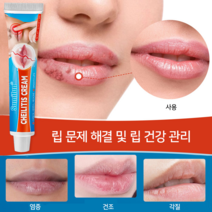 입술포진 연고 긴급구호 S-09, 1개, 20ml