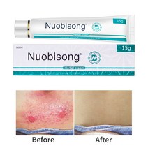 15ml Nuobisong 페이스 스킨 케어 트리트먼트 얼굴 트러블 스카 스트레치 마크 리무브 트러블 트리트먼트 화이트닝 모이스처라이징 크림