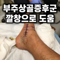 CB12 이룸건강 부주상골 증후군 깔창