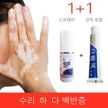 1+1 의료 백반증 질병 크림 흰 반점 안료 멜라닌 촉진제 피부 화이트 스팟 수리 치료 석고, 1 스프레이+1 고약 모양