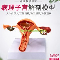 만삭태아 여성자궁모형 의료용 산부인과 인체모형, 병적자궁(지시카드포함)