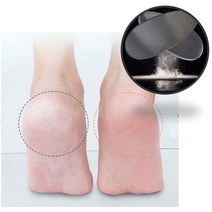 만능 발 각질 제거제 발바닥 껍질벗겨짐 제거기 뒤꿈치 갈라짐 발바닥 복숭아뼈 무좀 풋파일