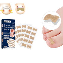 내성 발톱 교정 보호 테이프 파고드는 내향성 엄지발톱 자가치료 50매 1+1