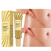 JoyPretty-색소 발색 교정기 흉터 제거 크림 여드름 치료 출산 스트레치 마크 미용 건강 40g