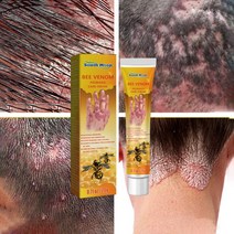 피부가려움증 연고 습진 크림 모낭염 두피 건선연고 지루성피부염 치료, 20ml, 1개