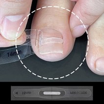 [특허청 실안신용 의료기기] 퍼펙토 내성발톱 교정 자가치료 스트립 세트, 20mm 세트