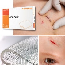 시카케어 연고 겔 수술 상처 켈로이드 제왕절개 흉터 연고 제거, 시카케어 젤시트(중형)