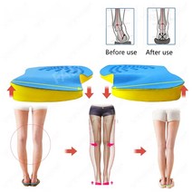 팔자걸음 안짱따리깥창 오다리 아치형 기능성 발편한 깔창