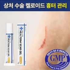 힐텀스카겔 흉터 연고 15g, 1개, 15ml