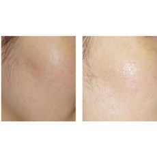 다자연 어성초 마스크팩, 1매입, 5개