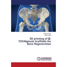 3D Printing of -TCP/Alginate Scaffolds for Bone Regeneration Paperback, LAP Lambert Academic Publishing