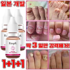 [당일 배송] 1+1/2+2 손톱 발톱 무좀 앰플 발톱 영양제 문제성 발톱 케어 효과보장/선물 랜덤 증정, 3개, 10ml - 레오클린