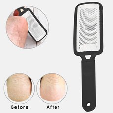 Microplane Grater For Feet Heel Rasp 파일 발 페디큐어 캘러스 리무버 하드 데드 스킨 스크러버 매니큐어 도구 Black Foot Scrub|풋 케어 공구|, 1개(A0), 1(A0)