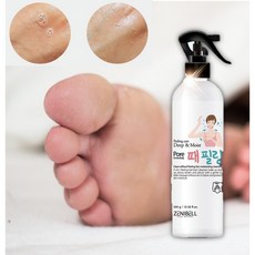 발바닥각질무좀